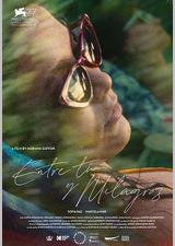 在你和米拉格罗斯之间